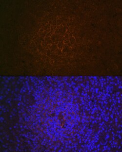 Invitrogen CD21 Recombinant Rabbit Monoclonal Antibody (1T2Z9) 100 &mu;L | Buy Online | Invitrogen&trade; | Fisher Scientific