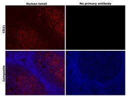 Invitrogen CD21 Recombinant Rabbit Monoclonal Antibody (1T2Z9) 100 &mu;L | Buy Online | Invitrogen&trade; | Fisher Scientific
