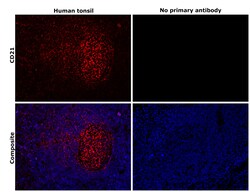 Invitrogen CD21 Recombinant Rabbit Monoclonal Antibody (1T2Z9) 100 &mu;L | Buy Online | Invitrogen&trade; | Fisher Scientific