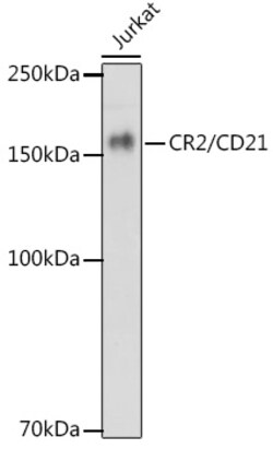 Invitrogen CD21 Recombinant Rabbit Monoclonal Antibody (1T2Z9) 100 &mu;L | Buy Online | Invitrogen&trade; | Fisher Scientific