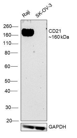 Invitrogen CD21 Recombinant Rabbit Monoclonal Antibody (1T2Z9) 100 &mu;L | Buy Online | Invitrogen&trade; | Fisher Scientific