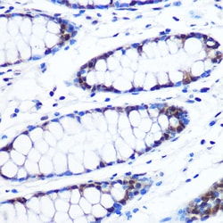 Invitrogen BRD4 Recombinant Rabbit Monoclonal Antibody (7L7M8) 100 &mu;L;