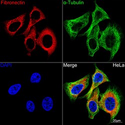Invitrogen Fibronectin Recombinant Rabbit Monoclonal Antibody (5I8T1) 100