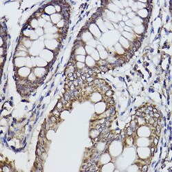 Invitrogen FKTN Recombinant Rabbit Monoclonal Antibody (7J5N6) 100 &mu;L;