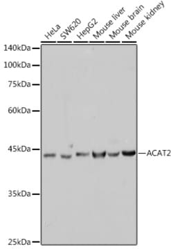 Invitrogen ACAT2 Recombinant Rabbit Monoclonal Antibody (6Z5L1) 100 &mu;L | Buy Online | Invitrogen&trade; | Fisher Scientific