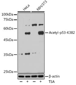 Invitrogen Acetyl-p53 (Lys382) Recombinant Rabbit Monoclonal Antibody 100