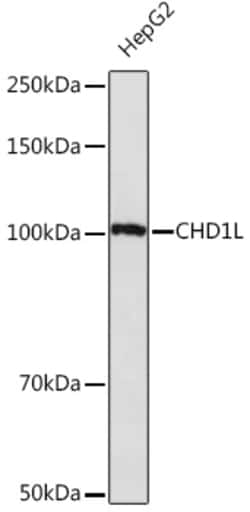 Invitrogen CHD1L Recombinant Rabbit Monoclonal Antibody (3C1O9) 100 &mu;L | Buy Online | Invitrogen&trade; | Fisher Scientific