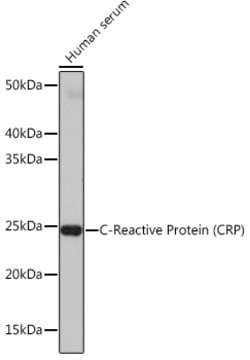 Invitrogen CRP Recombinant Rabbit Monoclonal Antibody (10J2R8) 100 &mu;L;