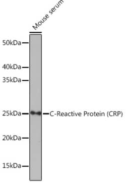 Invitrogen CRP Recombinant Rabbit Monoclonal Antibody (10J2R8) 100 &mu;L;