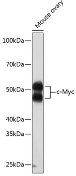 Invitrogen c-Myc Recombinant Rabbit Monoclonal Antibody (2O3U10) 100 &mu;L;