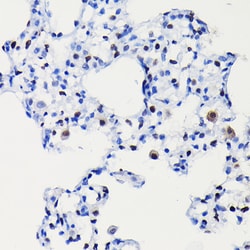 Invitrogen Cyclin D1 Recombinant Rabbit Monoclonal Antibody (7C8Z4) 100