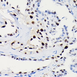 Invitrogen Cyclin D1 Recombinant Rabbit Monoclonal Antibody (7C8Z4) 100