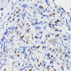 Invitrogen Cyclin D1 Recombinant Rabbit Monoclonal Antibody (7C8Z4) 100