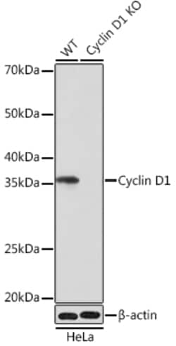 Invitrogen Cyclin D1 Recombinant Rabbit Monoclonal Antibody (7C8Z4) 100