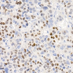Invitrogen p21 Recombinant Rabbit Monoclonal Antibody (4Z1H9) 100 &mu;L;