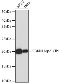 Invitrogen p21 Recombinant Rabbit Monoclonal Antibody (4Z1H9) 100 &mu;L;