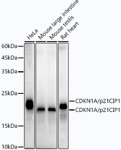 Invitrogen p21 Recombinant Rabbit Monoclonal Antibody (4Z1H9) 100 &mu;L;