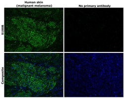 Invitrogen S100B Recombinant Rabbit Monoclonal Antibody (4V8R6) 100 &mu;L | Buy Online | Invitrogen&trade; | Fisher Scientific