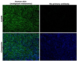 Invitrogen S100B Recombinant Rabbit Monoclonal Antibody (4V8R6) 100 &mu;L | Buy Online | Invitrogen&trade; | Fisher Scientific