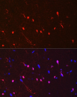 Invitrogen S100B Recombinant Rabbit Monoclonal Antibody (4V8R6) 100 &mu;L | Buy Online | Invitrogen&trade; | Fisher Scientific