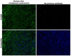 Invitrogen S100B Recombinant Rabbit Monoclonal Antibody (4V8R6) 100 &mu;L | Buy Online | Invitrogen&trade; | Fisher Scientific