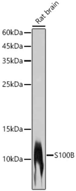 Invitrogen S100B Recombinant Rabbit Monoclonal Antibody (4V8R6) 100 &mu;L | Buy Online | Invitrogen&trade; | Fisher Scientific