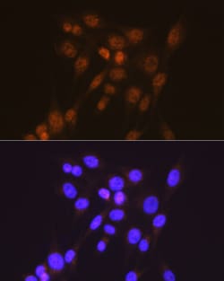 Invitrogen SMAD2 Recombinant Rabbit Monoclonal Antibody (2E3D8) 100 &mu;L;