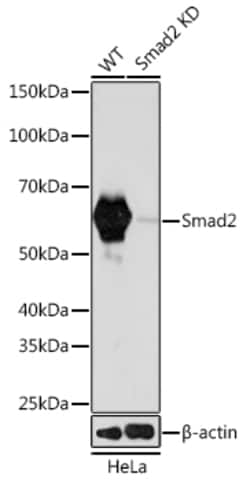 Invitrogen SMAD2 Recombinant Rabbit Monoclonal Antibody (2E3D8) 100 &mu;L;