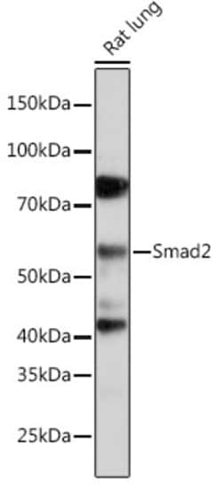 Invitrogen SMAD2 Recombinant Rabbit Monoclonal Antibody (2E3D8) 100 &mu;L;
