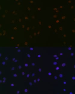 Invitrogen SPT5 Recombinant Rabbit Monoclonal Antibody (9V9G7) 100 &mu;L;