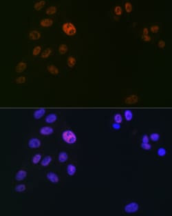 Invitrogen SPT5 Recombinant Rabbit Monoclonal Antibody (9V9G7) 100 &mu;L;