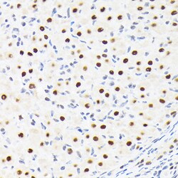 Invitrogen SPT5 Recombinant Rabbit Monoclonal Antibody (9V9G7) 100 &mu;L;