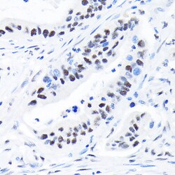 Invitrogen SPT5 Recombinant Rabbit Monoclonal Antibody (9V9G7) 100 &mu;L;