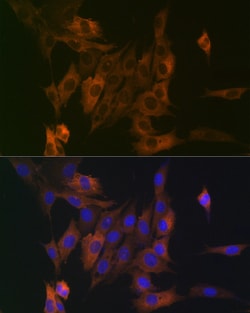 Invitrogen LPP Recombinant Rabbit Monoclonal Antibody (8M2R8) 100 &mu;L;