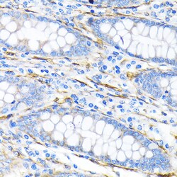 Invitrogen LPP Recombinant Rabbit Monoclonal Antibody (8M2R8) 100 &mu;L;