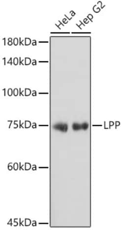 Invitrogen LPP Recombinant Rabbit Monoclonal Antibody (8M2R8) 100 &mu;L;