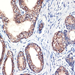 Invitrogen Arginase 2 Recombinant Rabbit Monoclonal Antibody (1Y5U3) 100