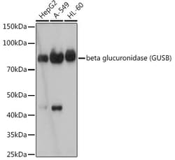 Invitrogen GUSB Recombinant Rabbit Monoclonal Antibody (4U0E2) 100 &mu;L | Buy Online | Invitrogen&trade; | Fisher Scientific