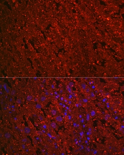 Invitrogen PROK1 Recombinant Rabbit Monoclonal Antibody (1B4G2) 100 &mu;L;