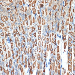 Invitrogen ATP4B Recombinant Rabbit Monoclonal Antibody (3Y1Y1) 100 &mu;L;