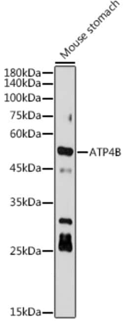 Invitrogen ATP4B Recombinant Rabbit Monoclonal Antibody (3Y1Y1) 100 &mu;L;