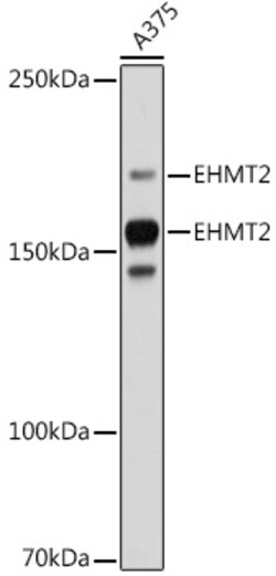 Invitrogen EHMT2 Recombinant Rabbit Monoclonal Antibody (2I0Q4) 100 &mu;L | Buy Online | Invitrogen&trade; | Fisher Scientific
