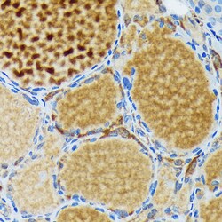 Invitrogen Thyroid Peroxidase Recombinant Rabbit Monoclonal Antibody (3C4A4)