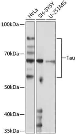Invitrogen Tau Recombinant Rabbit Monoclonal Antibody (6F5Z2) 100 &mu;L | Buy Online | Invitrogen&trade; | Fisher Scientific