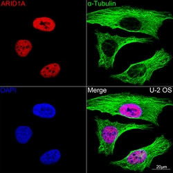 Invitrogen ARID1A Recombinant Rabbit Monoclonal Antibody (9D4J6) 100 &mu;L | Buy Online | Invitrogen&trade; | Fisher Scientific