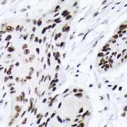 Invitrogen ARID1A Recombinant Rabbit Monoclonal Antibody (9D4J6) 100 &mu;L | Buy Online | Invitrogen&trade; | Fisher Scientific