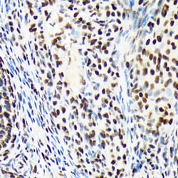Invitrogen ARID1A Recombinant Rabbit Monoclonal Antibody (9D4J6) 100 &mu;L | Buy Online | Invitrogen&trade; | Fisher Scientific