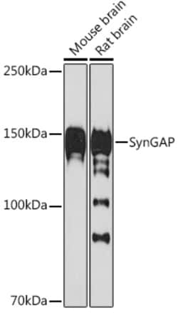 Invitrogen SynGAP Recombinant Rabbit Monoclonal Antibody (8M2S9) 100 &mu;L;
