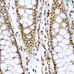 MAD2L1BP Recombinant Rabbit Monoclonal Antibody (7W8H1):Antibodies, Recombinant