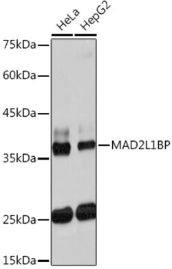 MAD2L1BP Recombinant Rabbit Monoclonal Antibody (7W8H1):Antibodies, Recombinant